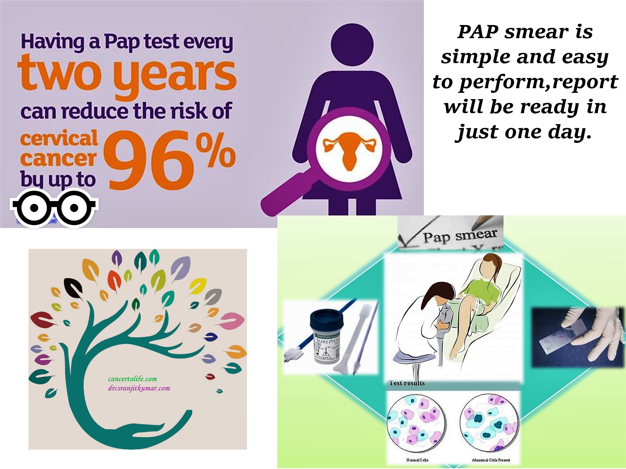 Cervical cancer