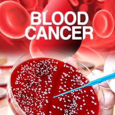 blood cancer treatment